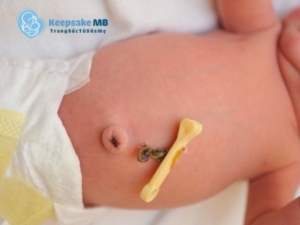 Cuống rốn có ý nghĩa gì_Keepsake MB