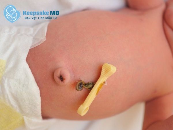 Có nên giữ cuống rốn cho con _ Keepsake MB _ Lưu giữ cuống rốn con