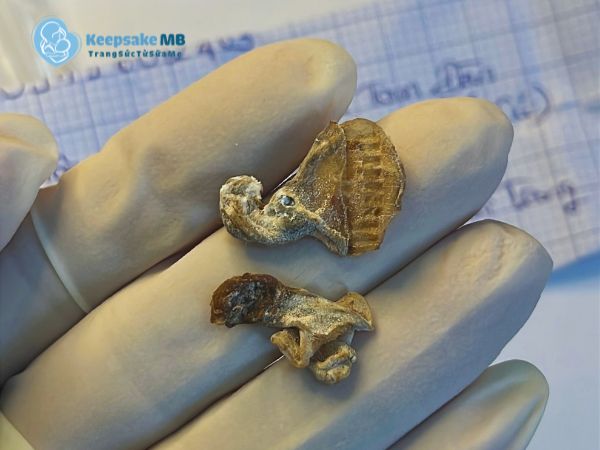 Cuống rốn sau sinh nên làm gì? Cách xử lý và lưu giữ đúng cách cho bé 3 Cách bảo quản lưu giữ cuống rốn Keepsake MB2